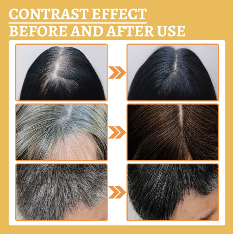 Natural Anti-Grey Hair Spray 30ml – Herbal Hair Darkening Essence for Men & Women, Damage-Free Color Restore